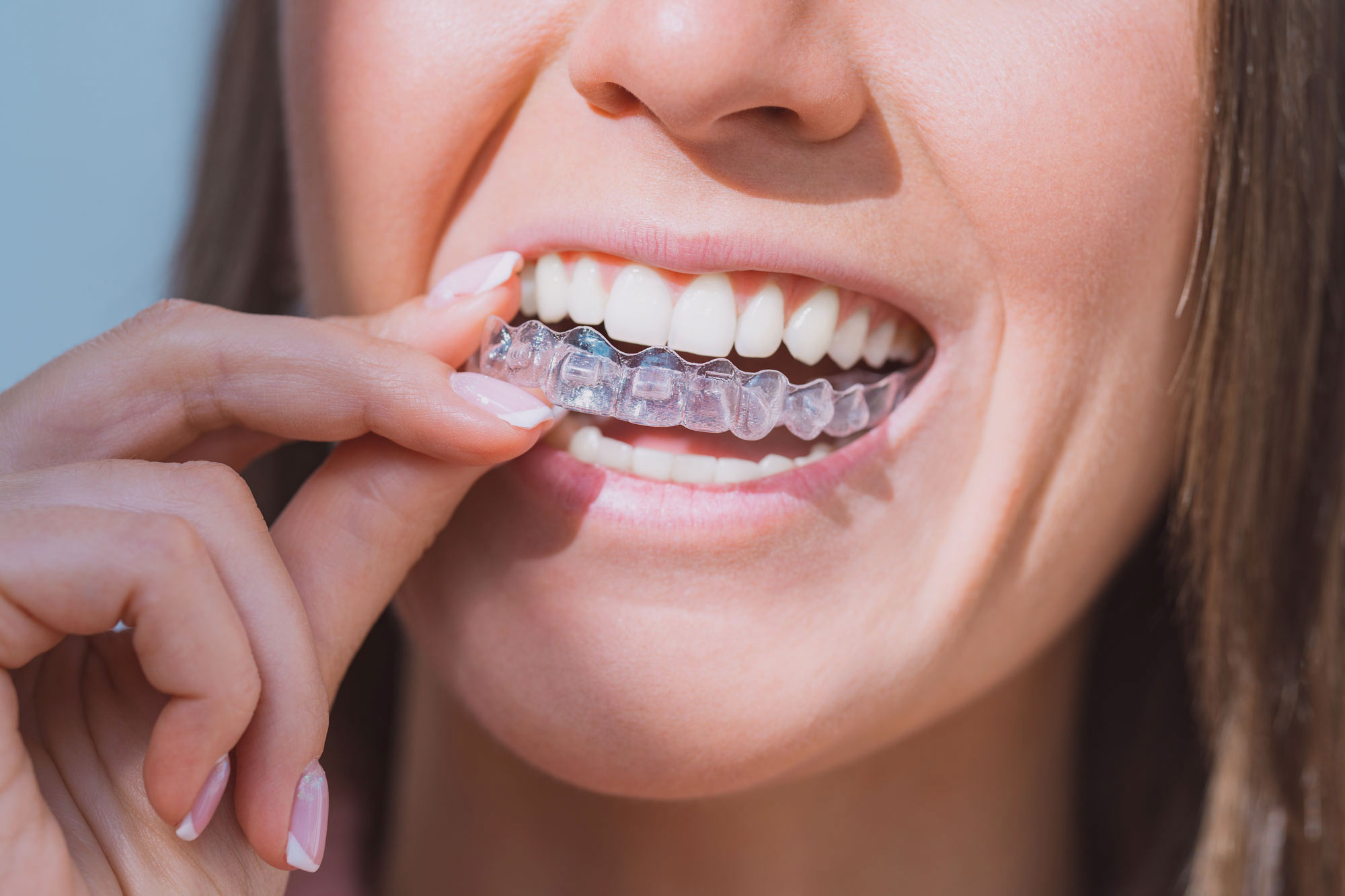 Smiling woman with straight teeth, representing the benefits of Invisalign treatment at Culver City Premium Dental Care