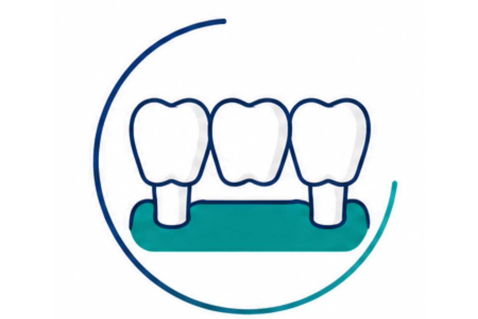 Dental crowns and bridges restorative treatment consultation