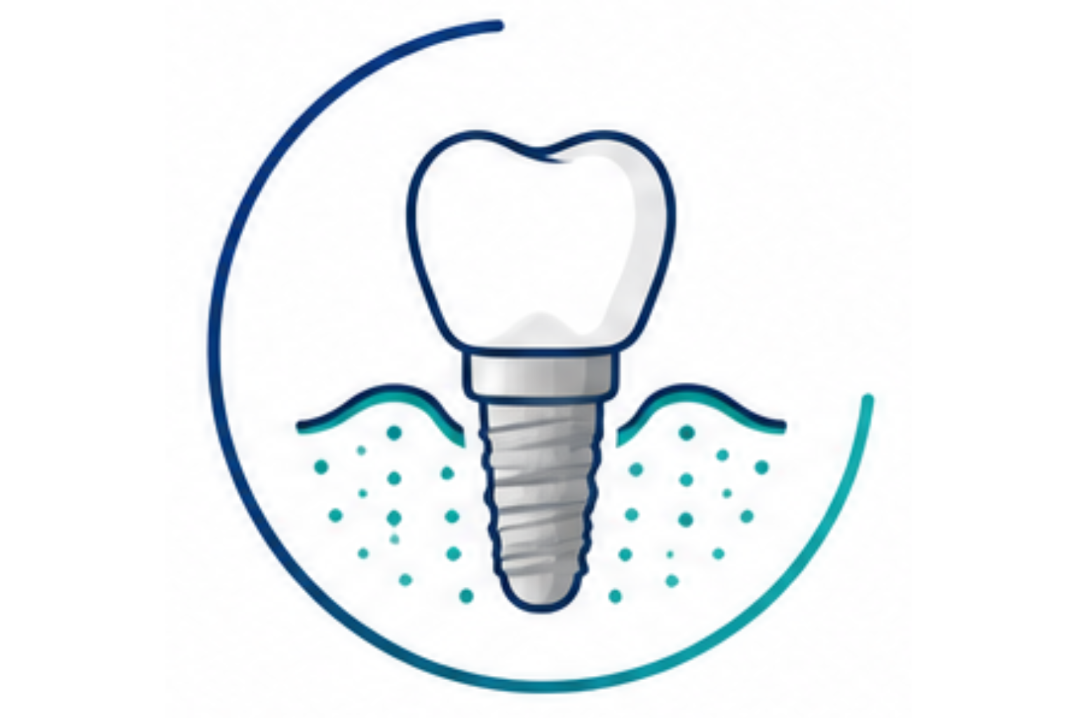 Dental implant consultation in modern Culver City dental clinic