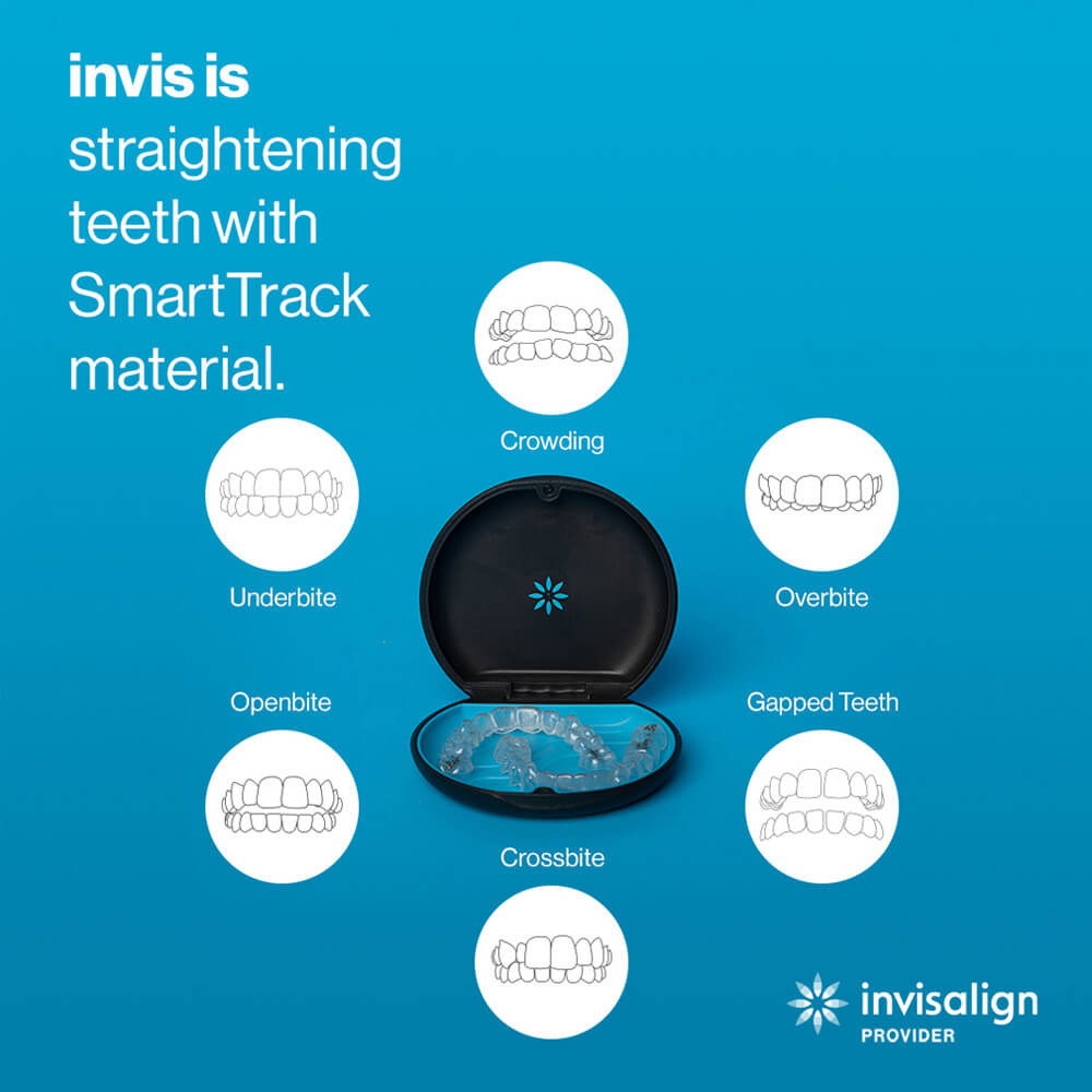 Invisalign SmartTrack material treats crowding, underbite, overbite, crossbite, open bite and gapped teeth